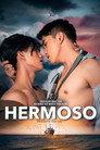 Hermoso