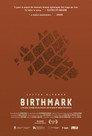 BIRTHMARK